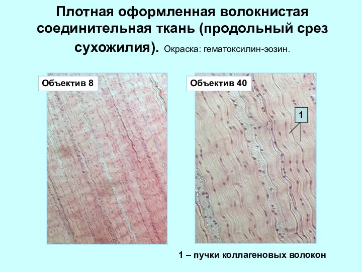 Плотная оформленная волокнистая соединительная ткань (продольный срез сухожилия). Окраска: гематоксилин-эозин.