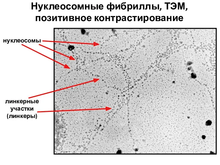 Нуклеосомные фибриллы, ТЭМ, позитивное контрастирование линкерные участки (линкеры) нуклеосомы