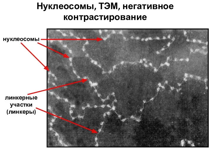 Нуклеосомы, ТЭМ, негативное контрастирование линкерные участки (линкеры) нуклеосомы