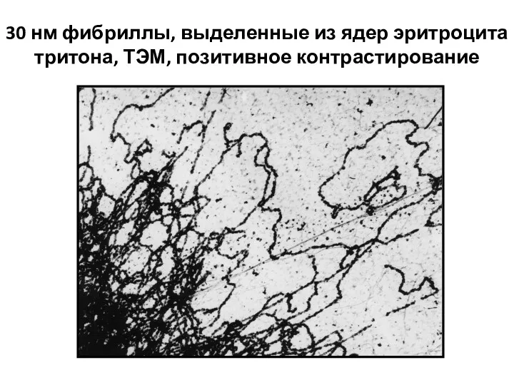 30 нм фибриллы, выделенные из ядер эритроцита тритона, ТЭМ, позитивное контрастирование