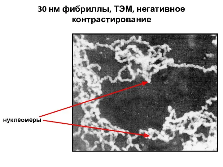 30 нм фибриллы, ТЭМ, негативное контрастирование нуклеомеры