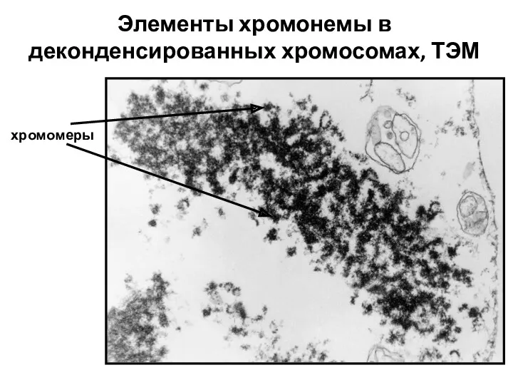 Элементы хромонемы в деконденсированных хромосомах, ТЭМ хромомеры