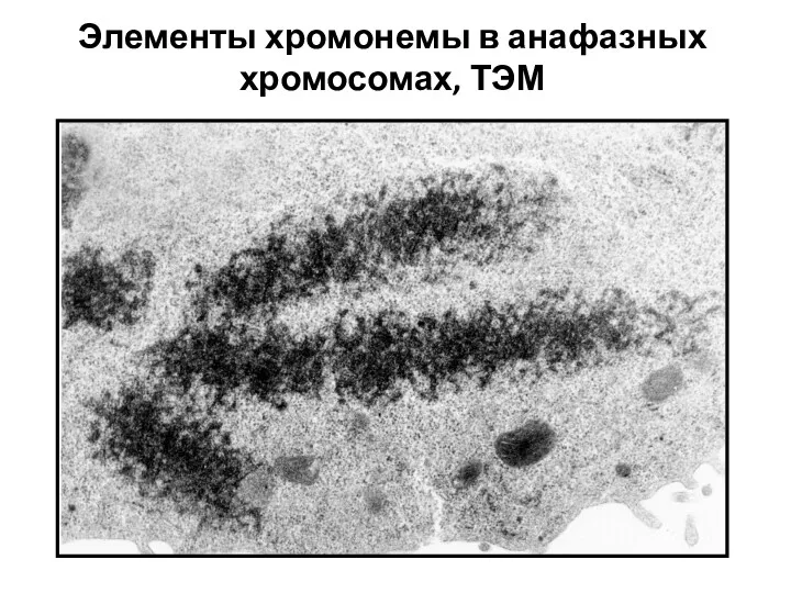 Элементы хромонемы в анафазных хромосомах, ТЭМ