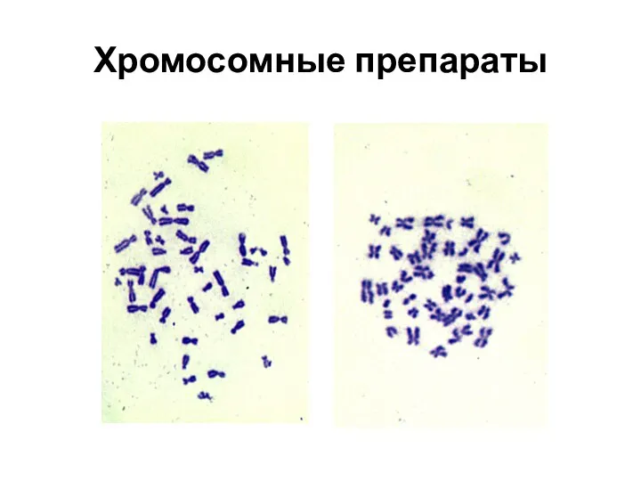 Хромосомные препараты