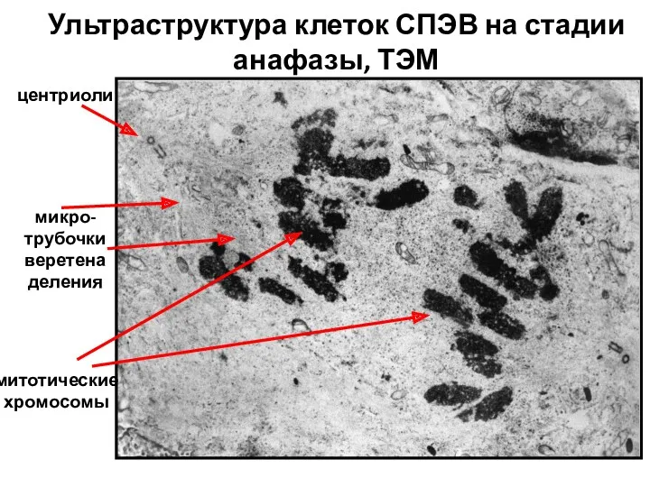 митотические хромосомы микро-трубочки веретена деления центриоли Ультраструктура клеток СПЭВ на стадии анафазы, ТЭМ