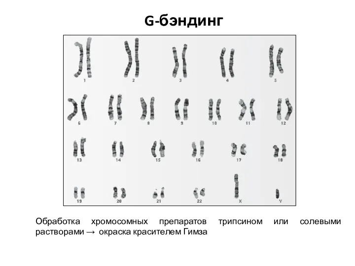 G-бэндинг Обработка хромосомных препаратов трипсином или солевыми растворами → окраска красителем Гимза