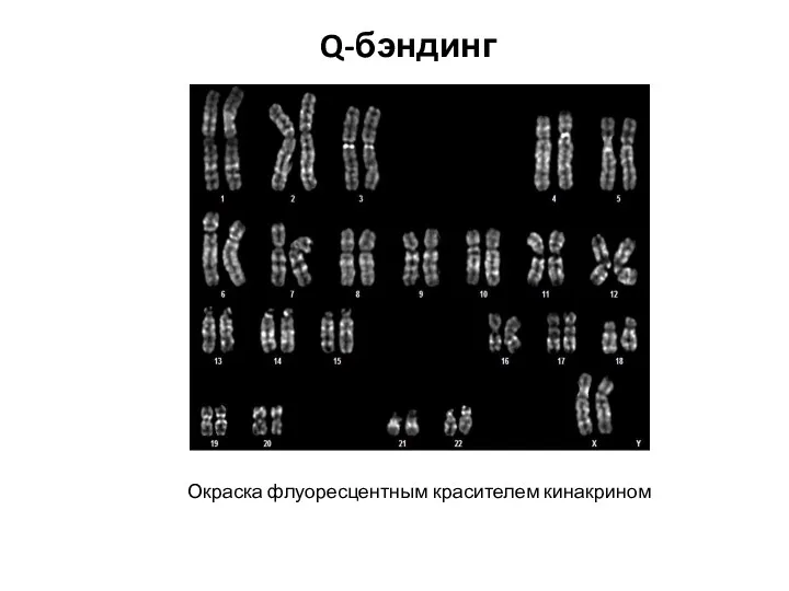 Q-бэндинг Окраска флуоресцентным красителем кинакрином