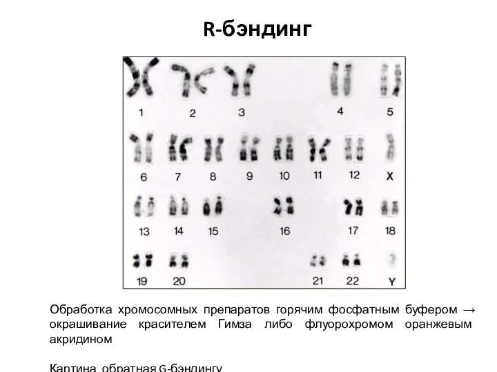Обработка хромосомных препаратов горячим фосфатным буфером → окрашивание красителем Гимза