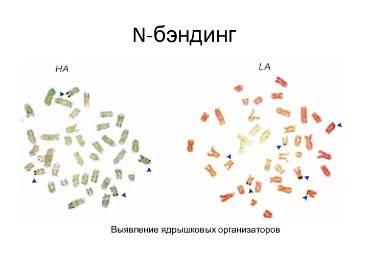 N-бэндинг Выявление ядрышковых организаторов