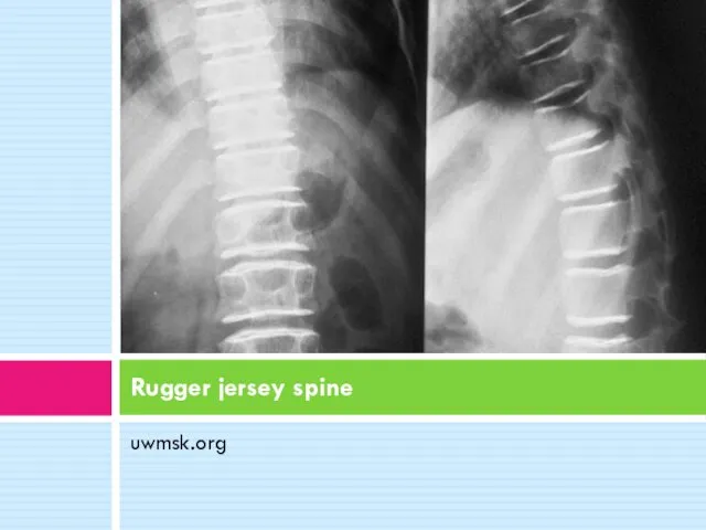 uwmsk.org Rugger jersey spine