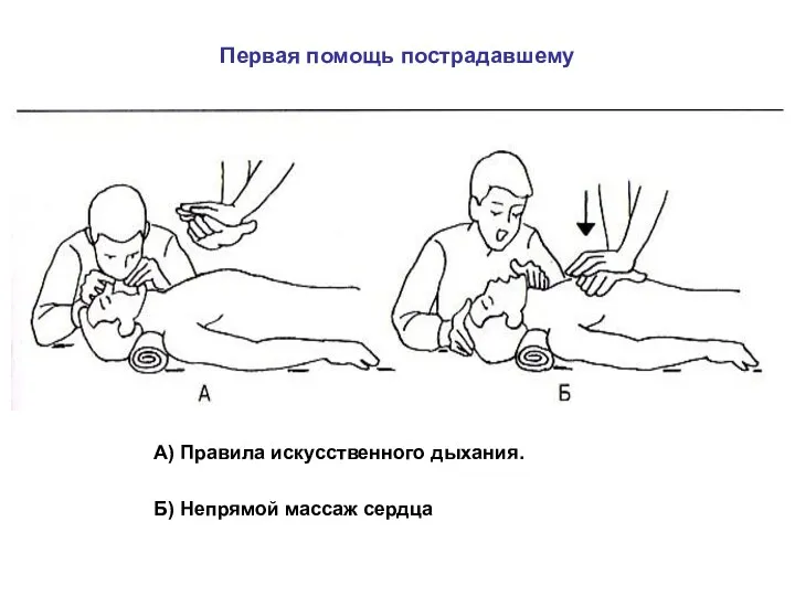 Первая помощь пострадавшему А) Правила искусственного дыхания. Б) Непрямой массаж сердца