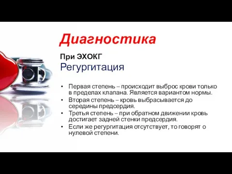 Диагностика При ЭХОКГ Регургитация Первая степень – происходит выброс крови