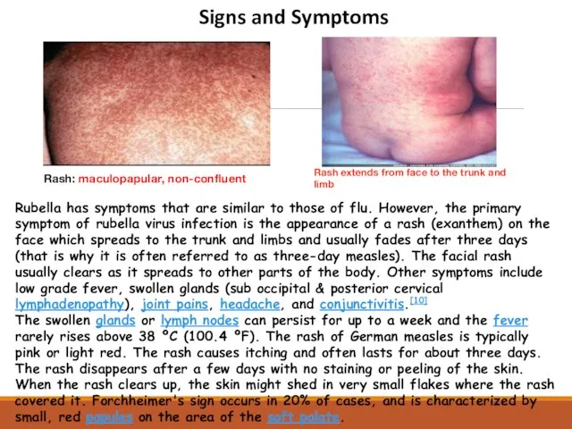 Rash extends from face to the trunk and limb Rash: