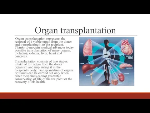 Organ transplantation Organ transplantation represents the removal of a viable organ from the