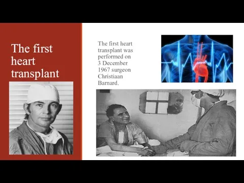 The first heart transplant The first heart transplant was performed on 3 December