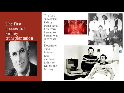 The first successful kidney transplantation The first successful kidney transplantation from human to