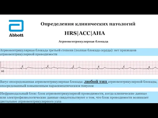 Определения клинических патологий HRS|ACC|AHA Атриовентрикулярная блокада ▲ ▲ Атриовентрикулярная блокада