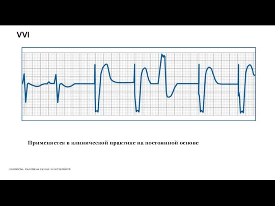 VVI Применяется в клинической практике на постоянной основе