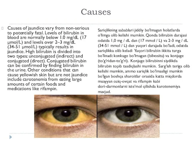 Causes Causes of jaundice vary from non-serious to potentially fatal.