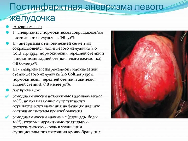 Постинфарктная аневризма левого желудочка Аневризма лж: I - аневризмы c нормокинезом сокращающейся части
