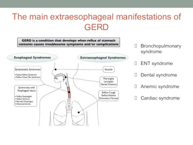 The main extraesophageal manifestations of GERD Bronchopulmonary syndrome ENT syndrome Dental syndrome Anemic syndrome Cardiac syndrome