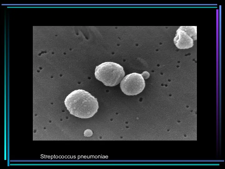 Streptococcus pneumoniae Streptococcus pneumoniae