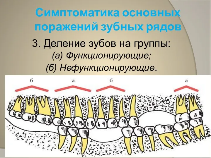 Симптоматика основных поражений зубных рядов 3. Деление зубов на группы: (а) Функционирующие; (б) Нефункционирующие.