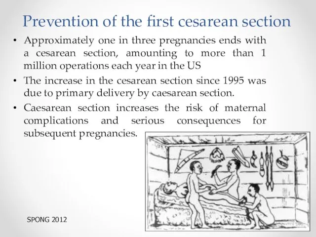 Prevention of the first cesarean section Approximately one in three