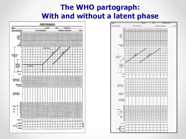 The WHO partograph: With and without a latent phase WHO 2007