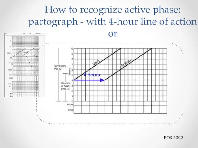 How to recognize active phase: partograph - with 4-hour line