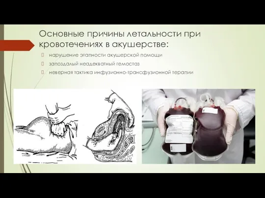 Основные причины летальности при кровотечениях в акушерстве: нарушение этапности акушерской