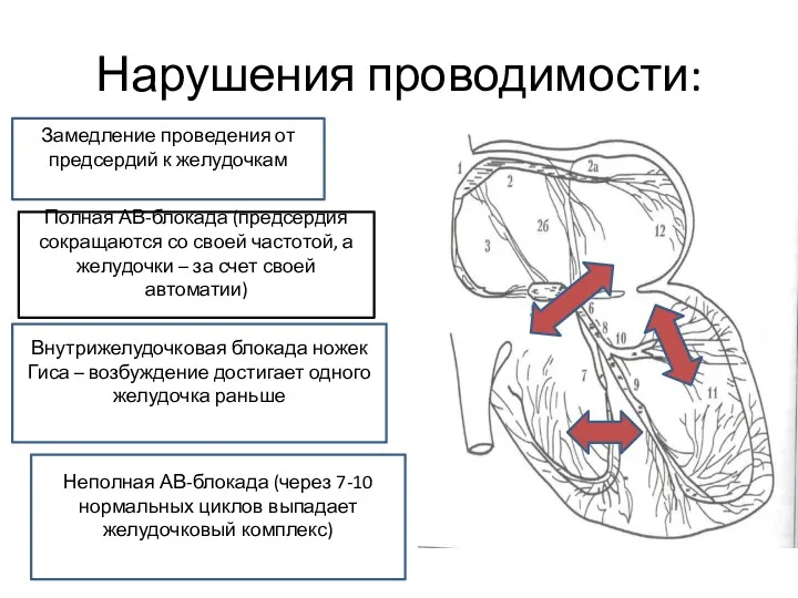 Нарушения проводимости: Замедление проведения от предсердий к желудочкам Неполная АВ-блокада