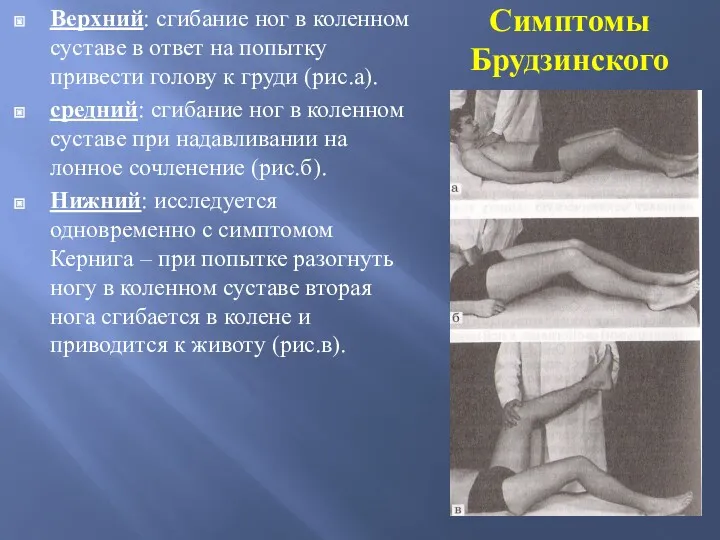 Симптомы Брудзинского Верхний: сгибание ног в коленном суставе в ответ на попытку привести