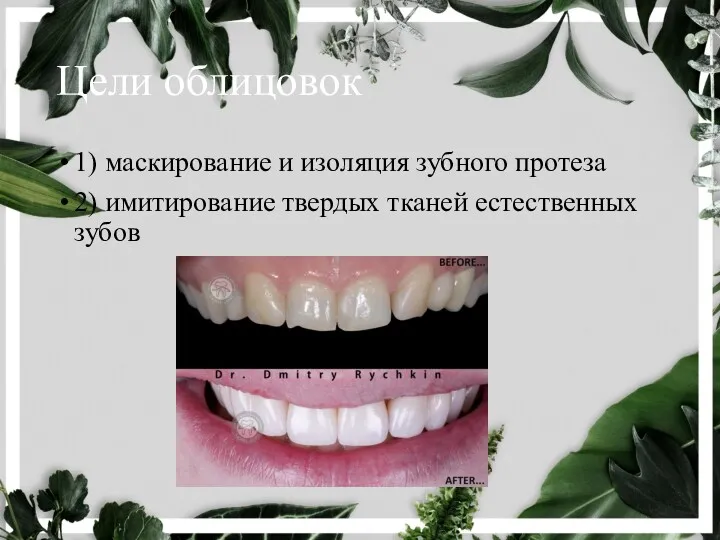 Цели облицовок 1) маскирование и изоляция зубного протеза 2) имитирование твердых тканей естественных зубов