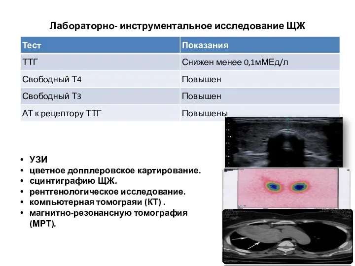 Лабораторно- инструментальное исследование ЩЖ УЗИ цветное допплеровское картирование. сцинтиграфию ЩЖ. рентгенологическое исследование. компьютерная