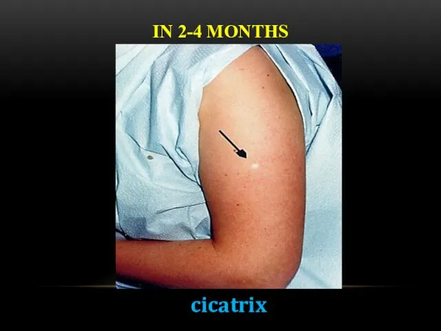 IN 2-4 MONTHS cicatrix