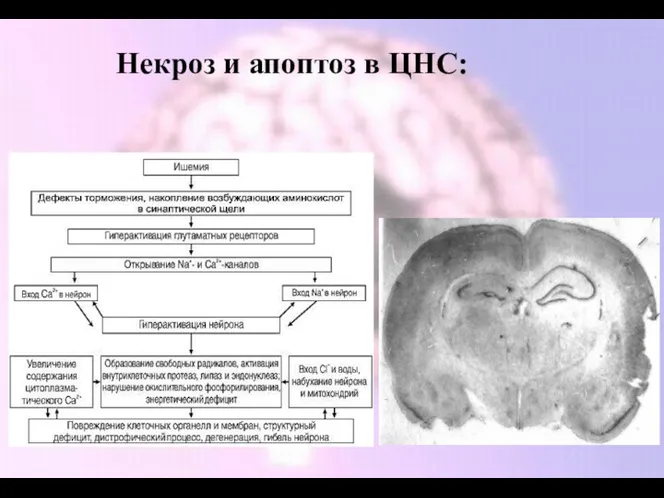 Некроз и апоптоз в ЦНС: