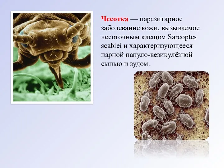 Чесотка — паразитарное заболевание кожи, вызываемое чесо­точным клещом Sarcoptes scabiei