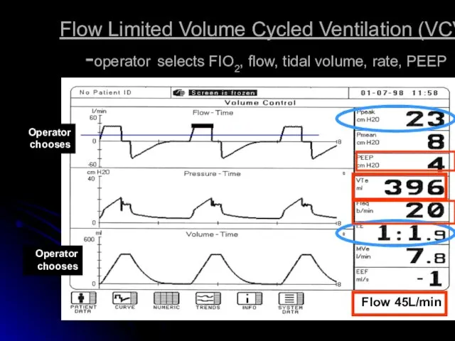Flow Limited Volume Cycled Ventilation (VCV) -operator selects FIO2, flow,