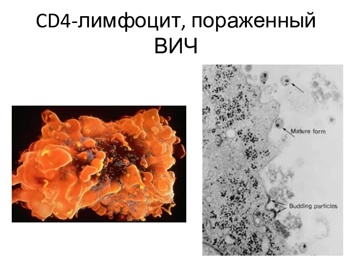 CD4-лимфоцит, пораженный ВИЧ