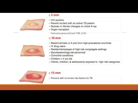 Immunosupressed (anti TNF, GCS)