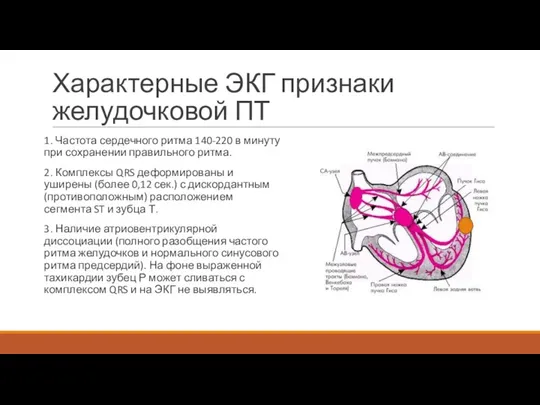 Характерные ЭКГ признаки желудочковой ПТ 1. Частота сердечного ритма 140-220