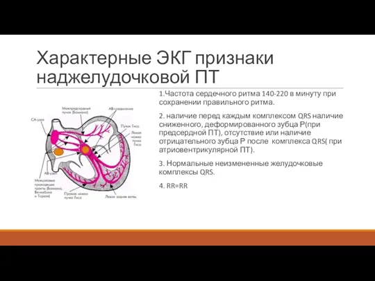 Характерные ЭКГ признаки наджелудочковой ПТ 1.Частота сердечного ритма 140-220 в