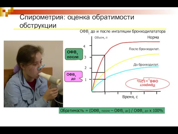 Спирометрия: оценка обратимости обструкции 4 ОФВ1 до и после ингаляции