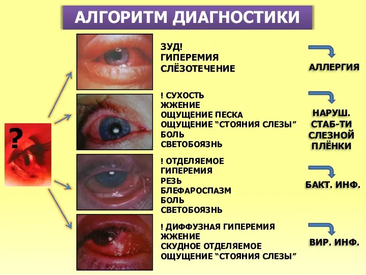 АЛГОРИТМ ДИАГНОСТИКИ ? ЗУД! ГИПЕРЕМИЯ СЛЁЗОТЕЧЕНИЕ ! СУХОСТЬ ЖЖЕНИЕ ОЩУЩЕНИЕ ПЕСКА ОЩУЩЕНИЕ “СТОЯНИЯ