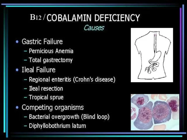 B12 /