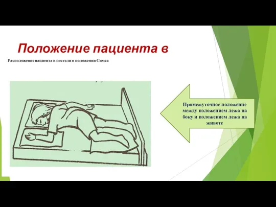 Положение пациента в постели Промежуточное положение между положением лежа на боку и положением лежа на животе