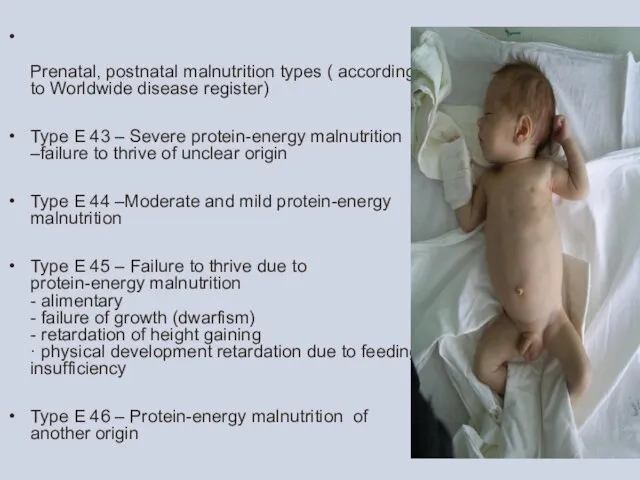 Prenatal, postnatal malnutrition types ( according to Worldwide disease register) Type Е 43