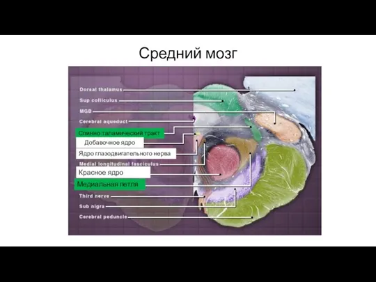 Средний мозг Спинно-таламический тракт Добавочное ядро Ядро глазодвигательного нерва Красное ядро Медиальная петля