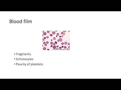 Blood film Fragments Schistocytes Paucity of platelets